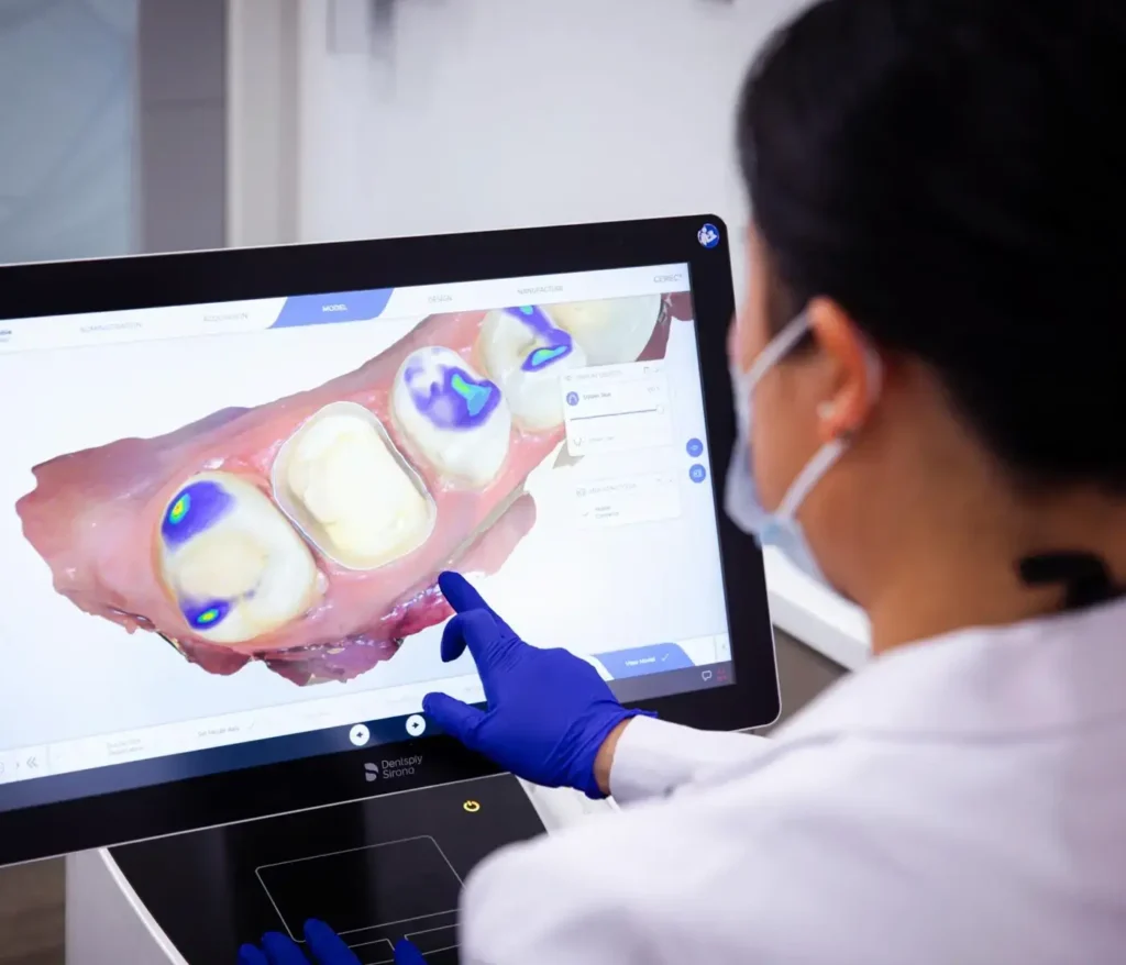 CEREC: Same Day Crown at Greenvale Dental House