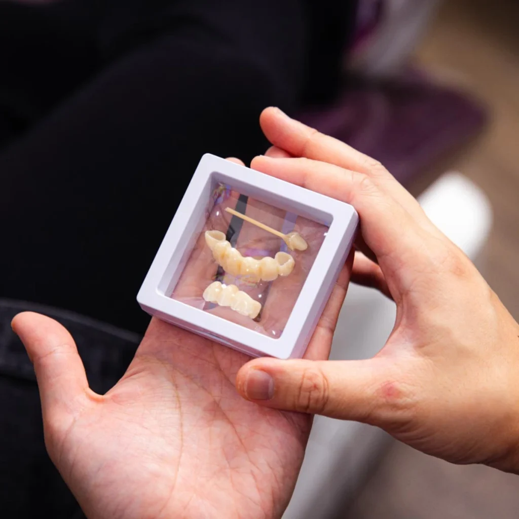 Dental Crowns & Bridges at Greenvale Dental House