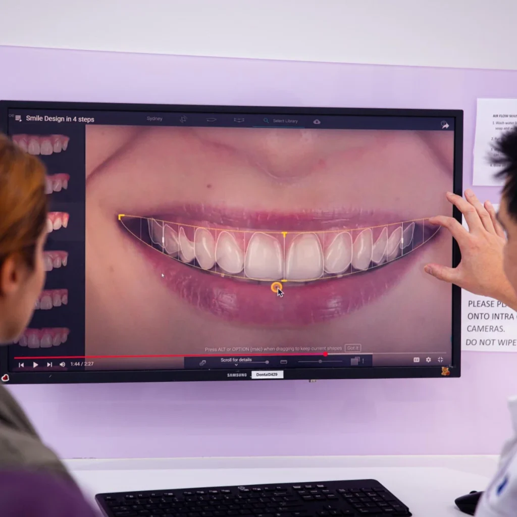 Digital Smile Design at Greenvale Dental House