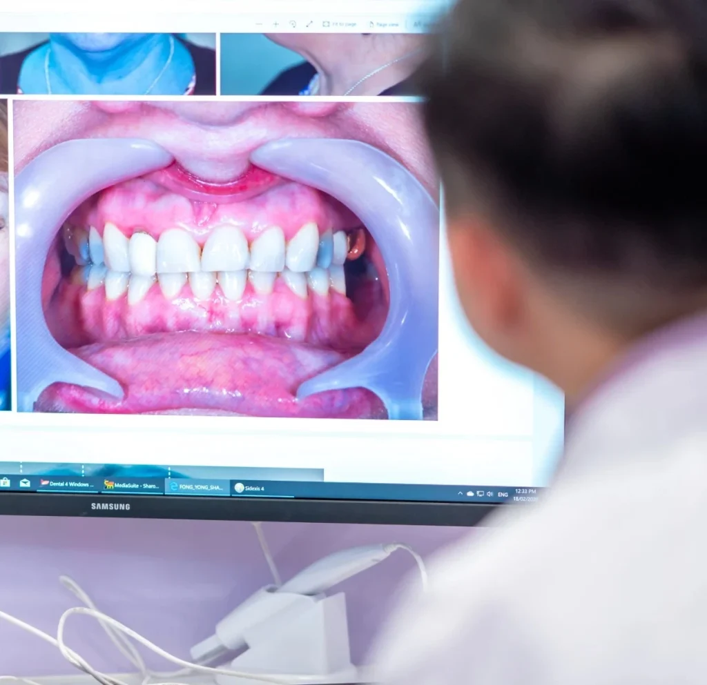 Gum Treatment at Greenvale Dental House