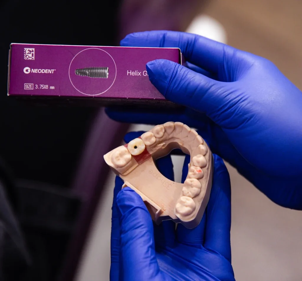 Immediate Implants at Greenvale Dental House