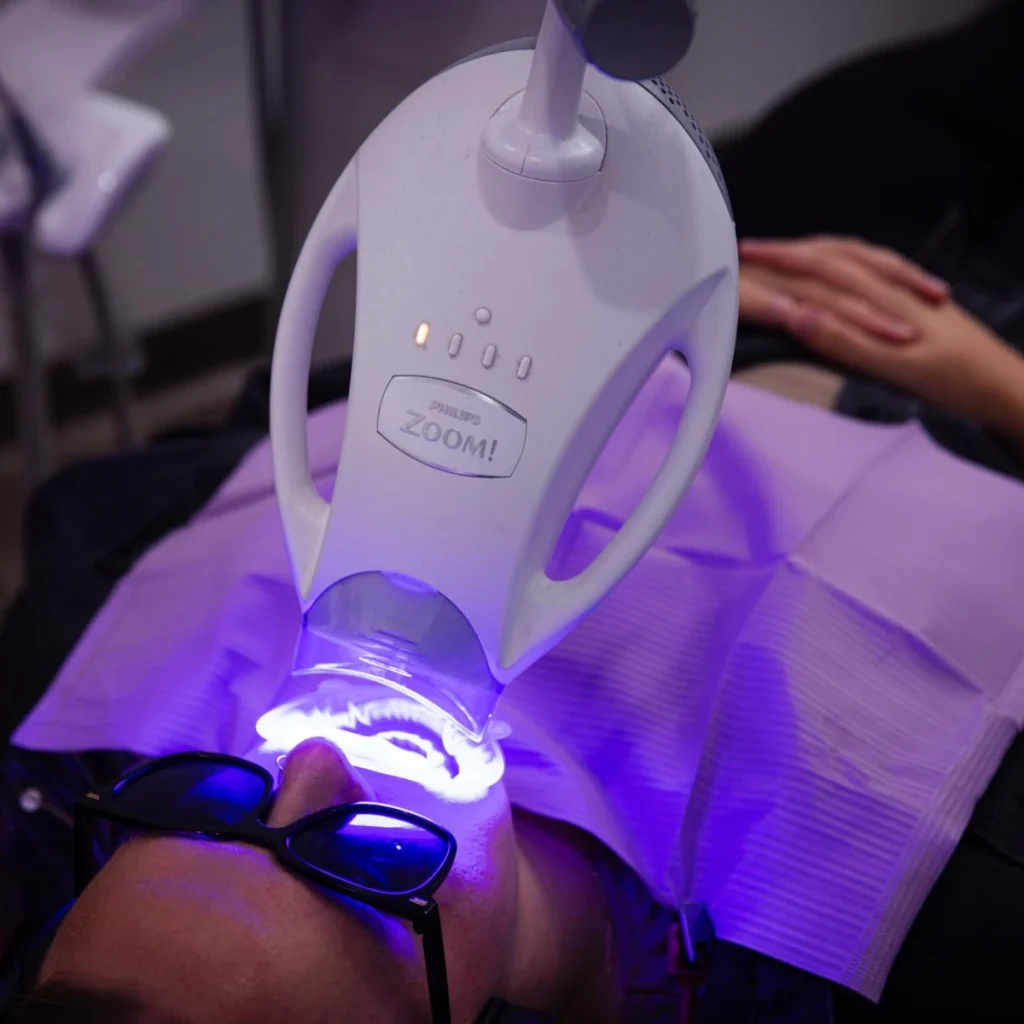Teeth Whitening at Greenvale Dental House