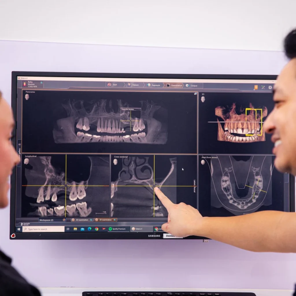 Wisdom Teeth Removal at Greenvale Dental House