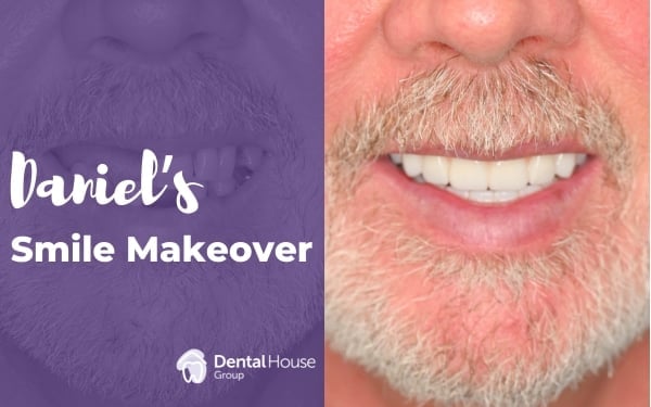 Daniel of Melbourne’s All-On-4 Journey in Greenvale Dental House