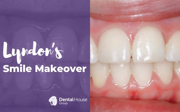 Lyndon of Melbourne’s Fixed Braces Journey in Greenvale Dental House