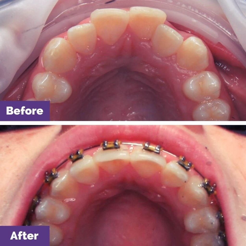 Orthodontics Journey in Gisborne