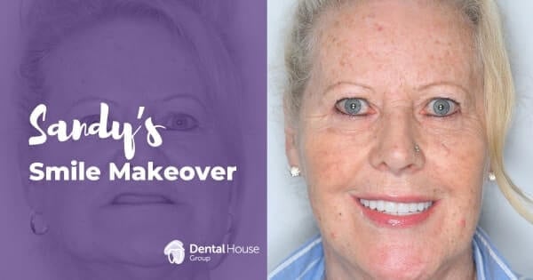 Sandy of Melbourne’s All-on-4 Journey in Greenvale Dental House