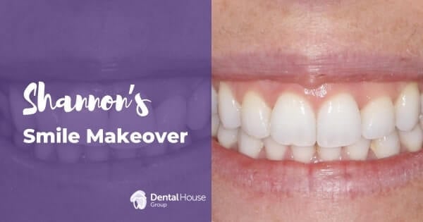 Shannon of Melbourne’s Invisalign Journey in Greenvale Dental House