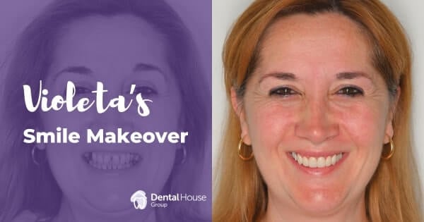 Violeta of Melbourne’s Implants and Veneers Journey in Greenvale Dental House