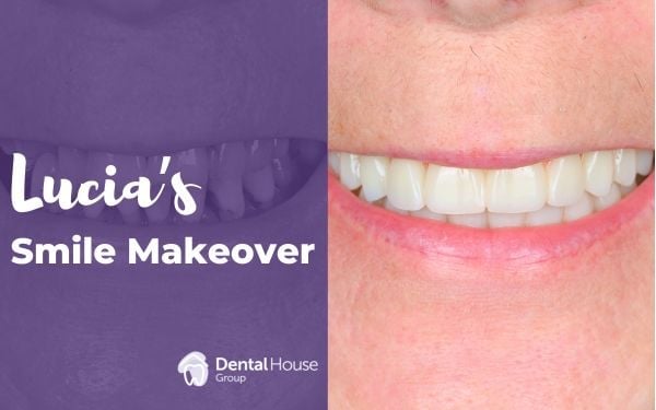 Lucia of Melbourne’s AO4 Smile ™ Journey in Greenvale Dental House