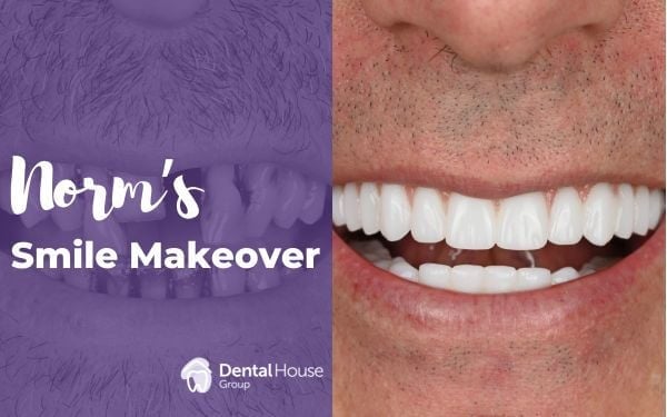 Norm Of Melbourne’s All On 4 Journey In Greenvale Dental House