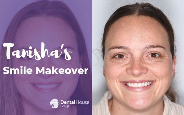 Tanisha of Melbourne’s Porcelain Veneers Smile Makeover in Greenvale Dental House