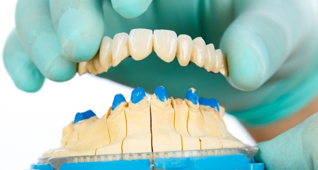 Multiple Missing Teeth One Bridge Might Be All You Need At Greenvale Dental House