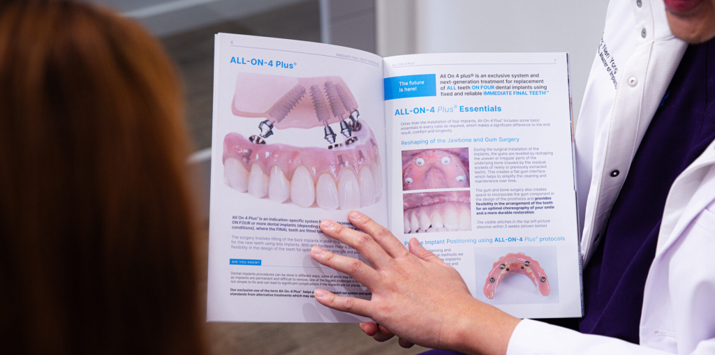 Dental implants