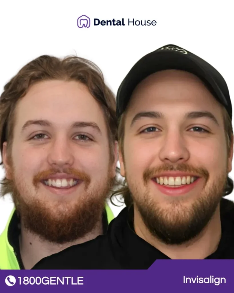 Invisalign at Greenvale Dental House in Greenvale, Craigieburn, Roxburgh Park, and Melbourne