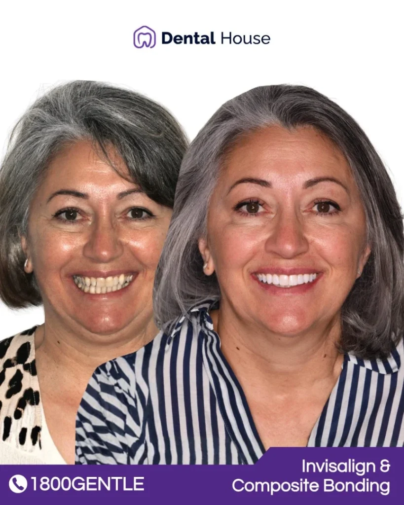 Invisalign at Greenvale Dental House in Greenvale, Craigieburn, Roxburgh Park, and Melbourne